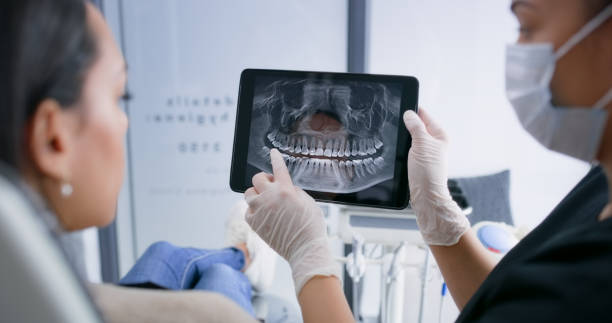 Licensed Tooth Extraction service in San Pablo, NM - Smile Center Dentistry